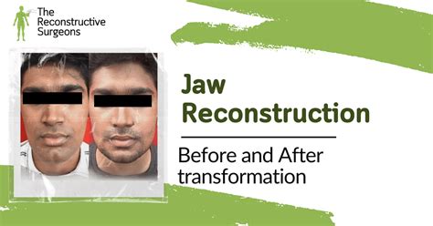 Blog - The Reconstructive Surgeons