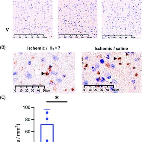 Image result for HepG2 Intraperitoneal Injection