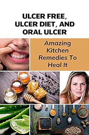 Ulcer Free, Ulcer Diet, And Oral Ulcer: Amazing Kitchen Remedies To ...