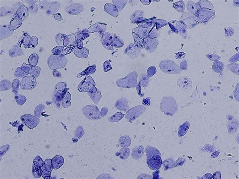 Cheek Cell Experiment Method 的图像结果