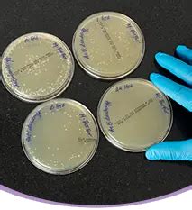 Anti Dandruff Test – AreoVeda