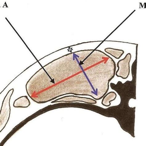 Geometric Method 的图像结果