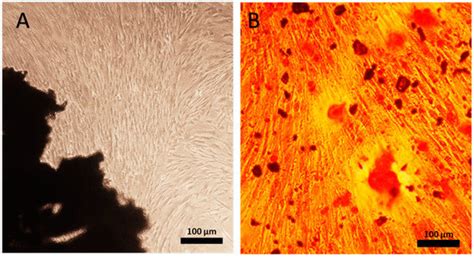 In Vivo Bone Regeneration Induced by a Scaffold of Chitosan ...