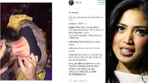 Kerokan - JungleKey.in Image #100