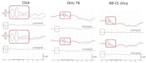 Use of an Extra-Tympanic Membrane Electrode to Record Cochlear ...