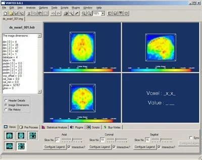 Image result for Vortex Data