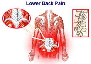 Image result for Left Lower Back Muscle Strain