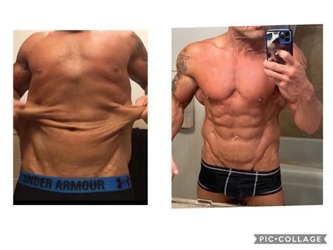 Discover more like PlasticSurgery: 2 years post op skin removal surgery. Start weight 376 pounds ...