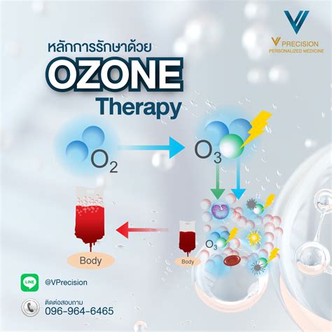 Ozone Therapy Treatment