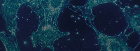 Image result for Accelerated Aging Causes