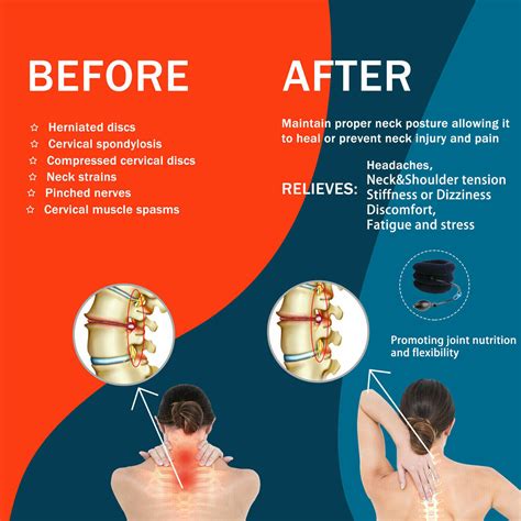 Buy Cervical Neck Traction Device Collar Brace Support Pain Relife ...