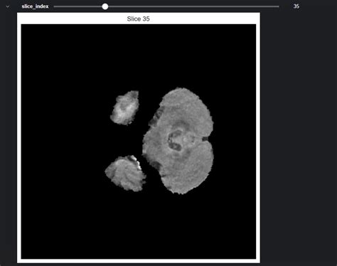 Image result for How to Extract Features From Nii Images in Python