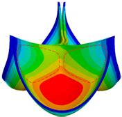 Numerical Simulation Studies on the Design of the Prosthetic Heart ...