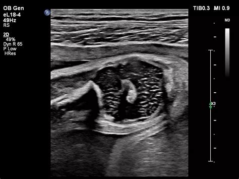 Philips - EPIQ 5 Ultrasound system for obstetrics and gynecology