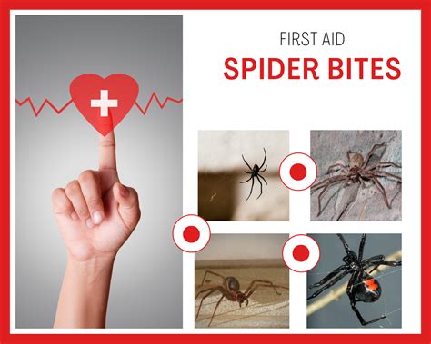 Spider Bites, treatment symptoms and first aid