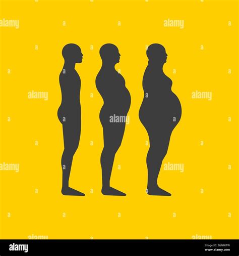 Stages of obesity of man. Silhouettes of person with different age from slim to overweight ...