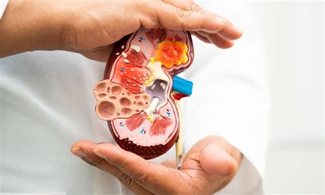 Research non committed about benefit of Vadadustat for symptomatic ...