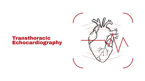 Transthoracic Echocardiography ~ Stat Cardiologist