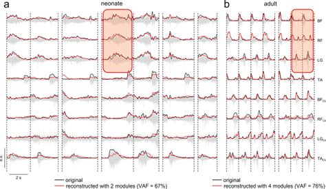 Image result for Muscle Activity EMG