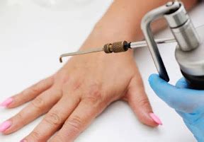 ক্রায়োসার্জারি কি? || What is Cryosurgery? - PROSHNO SOLVE