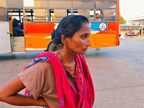 Acid was thrown on the woman in the pretense of love affair | પ્રેમ ...