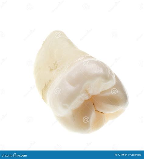 Extracted Wisdom Tooth 的图像结果