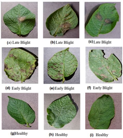 Potato Blight Detection Using Fine-Tuned CNN Architecture