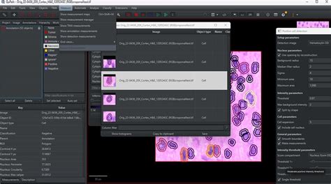 Image result for QuPath Image Analysis