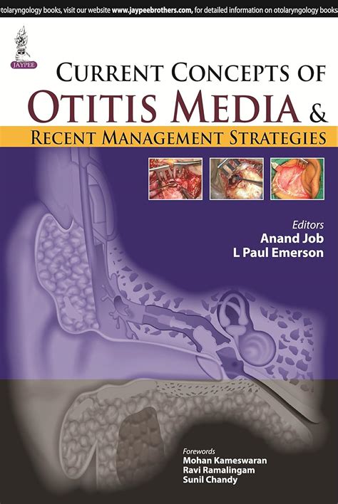 Buy Current Concepts of Otitis Media and Recent Management Strategies ...