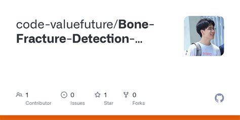 Bone Fracture Detection Using Image Processing Source Code GitHub 的图像结果