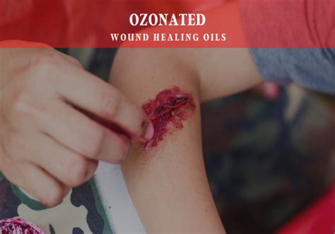 CAN YOU PUT OIL ON THE WOUND? – Asterveda Healthcare