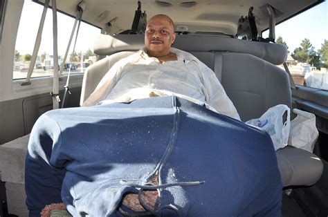 Elephantitis Testicals