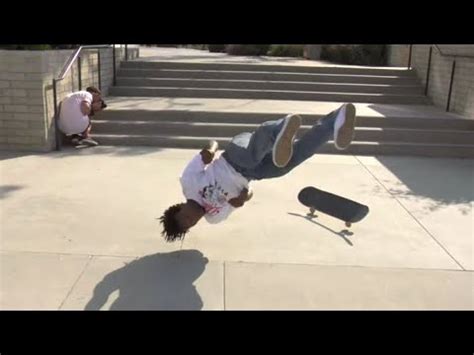 Image result for Large Pimples Exploding