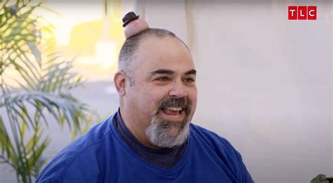 Horn Growing Out Of Head Dr Pimple Popper at Jeremy Rivera blog