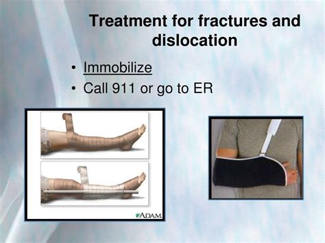 Image result for Dislocation First Aid