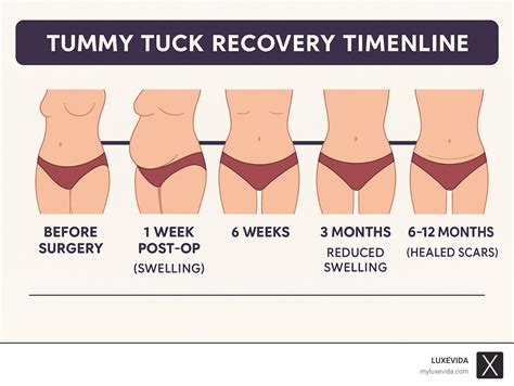 Tummy Tuck Before And After: 10 Stunning Results 2025