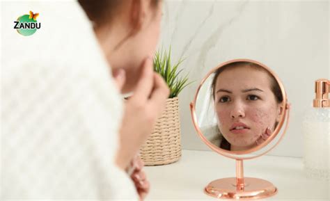 Aloe Vera: Benefits, Common Uses & Side Effects