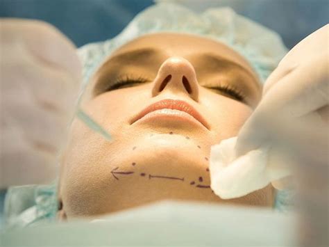 Best Doctor for Genioplasty in Mumbai - Nuface - Dr. Parit Ladani