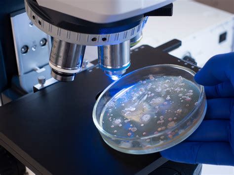 Pediatric invasive group A Streptococcal infections on the rise during ...