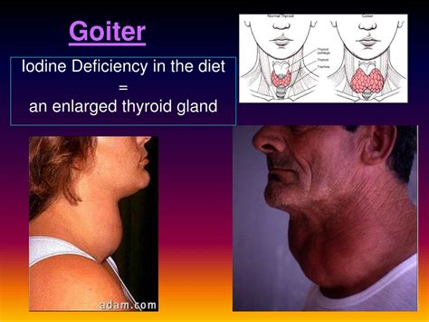 Image result for Thyroid Function Algorithm