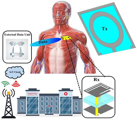 Design and Analysis of a Dual-Band Implantable Receiving Antenna for ...