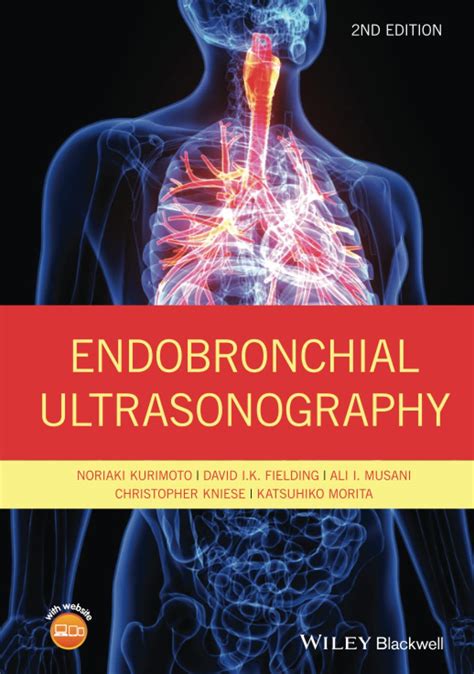 Buy Endobronchial Ultrasonography Book Online at Low Prices in India ...