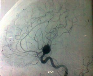 Dr. Partha Pratim Bishnu - India, Kolkata, Neurovascular Surgery ...