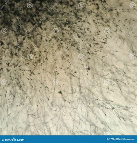 Penicillium Genus Fungus Under the Microscope Stock Photo - Image of ...
