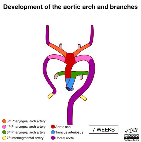 Aortic Arch Branches