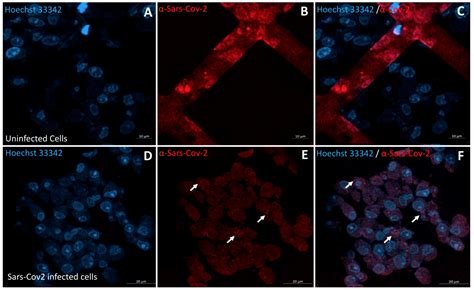 Microscopic Observation of SARS-Like Particles in RT-qPCR SARS-CoV-2 ...
