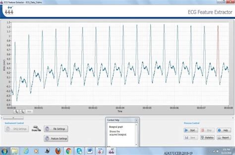 Image result for ECG Signal Feature Extraction Python