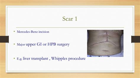 PPT - Surgical abdomen PowerPoint Presentation, free download - ID:8782727