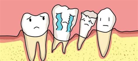 牙齿松动怎么办？能补救吗？等它掉还是拔牙？三大原因&对症治疗 - 知乎