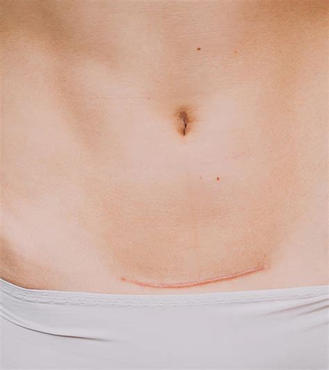 7 Causes Of Tooth Discoloration In Babies & Ways To Treat It